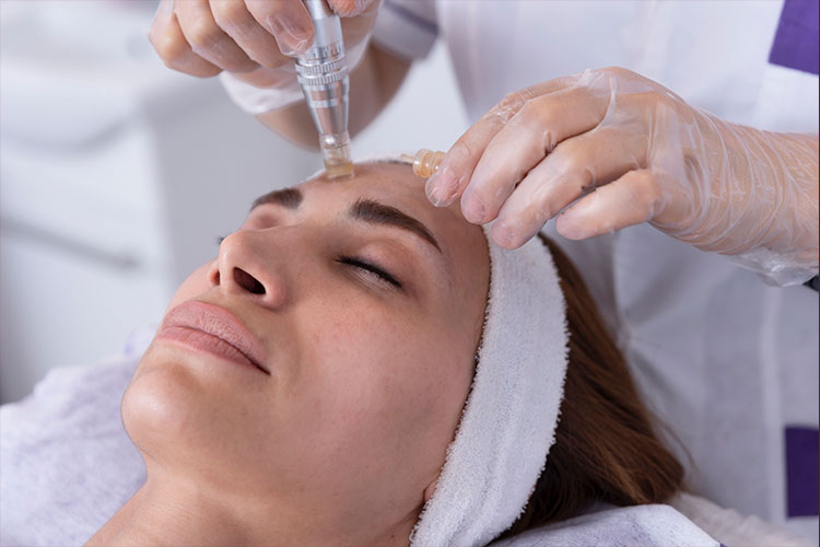 Chemical Peel Treatment at Prestige Aesthetic