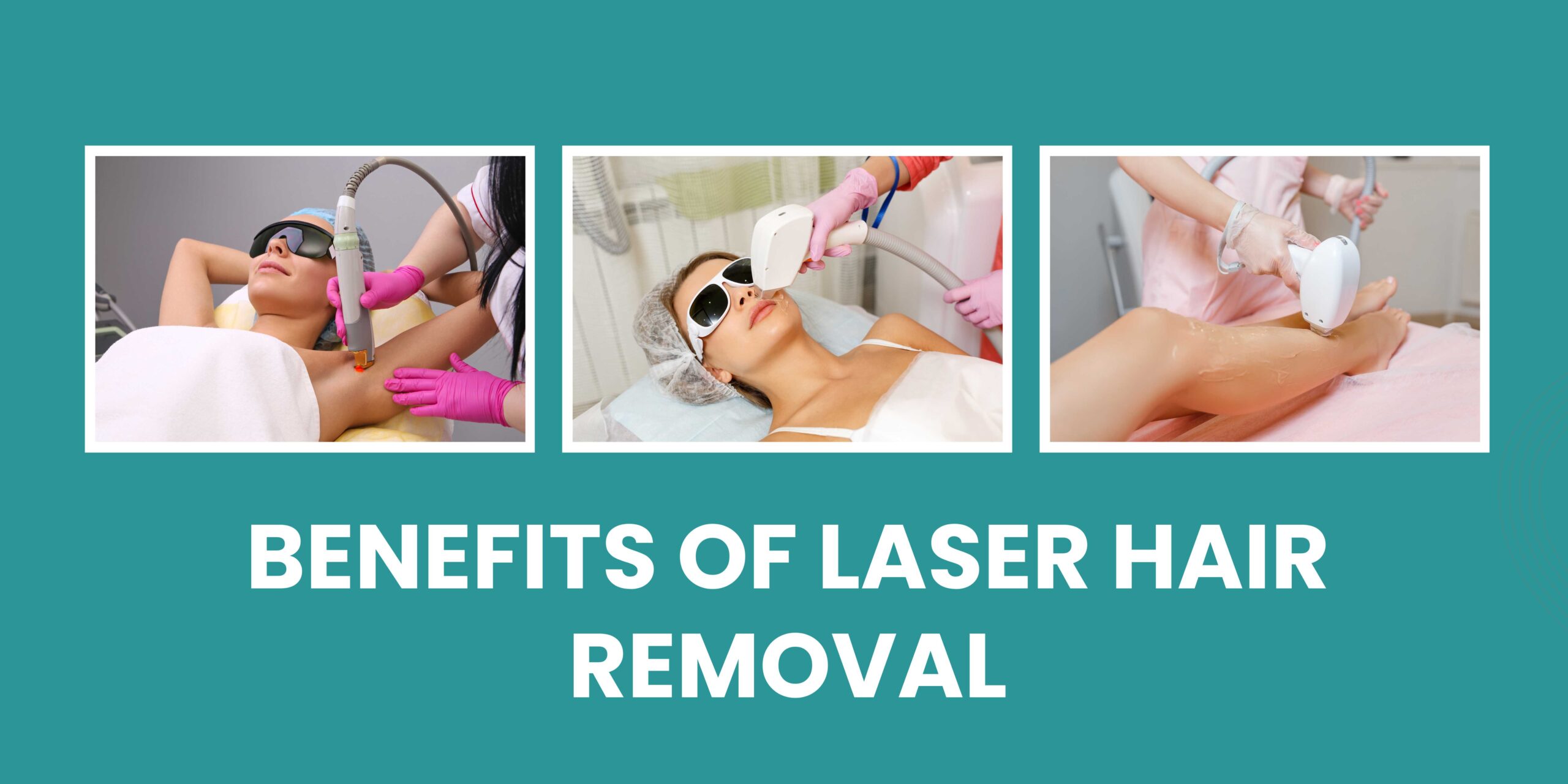 Laser Hair Removal