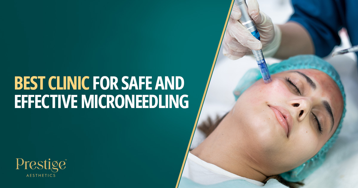 Best Clinic for safe and effective microneedling