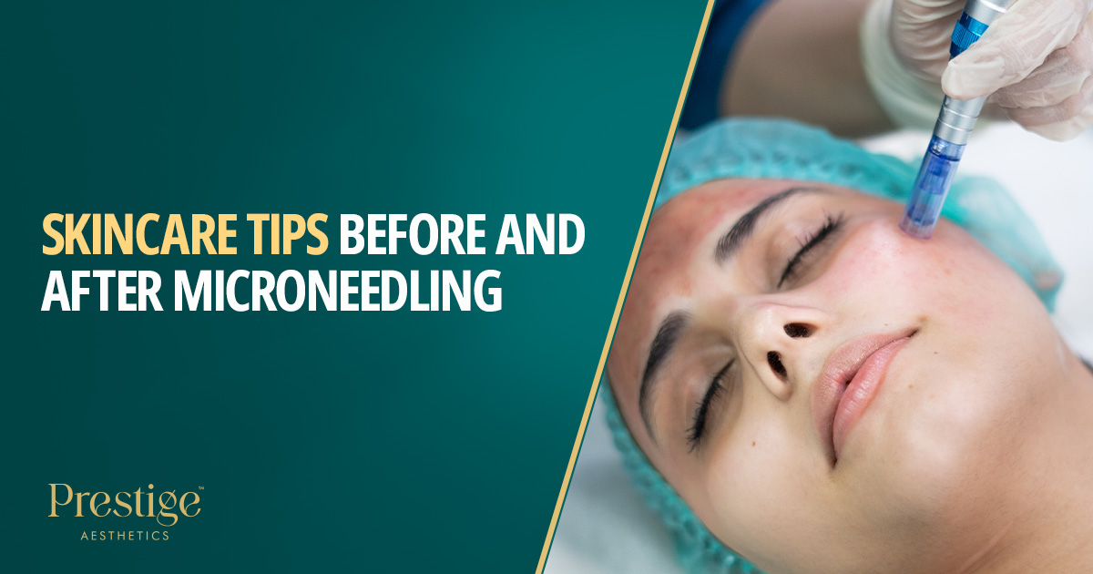 Skincare tips before and after microneedling