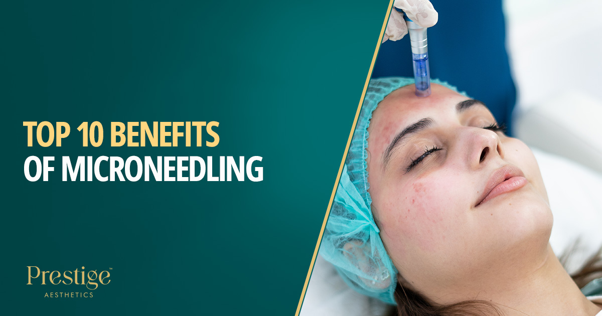 Top 10 benefits of microneedling