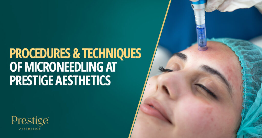 procedures and techniques of microneedling at prestige aesthetics