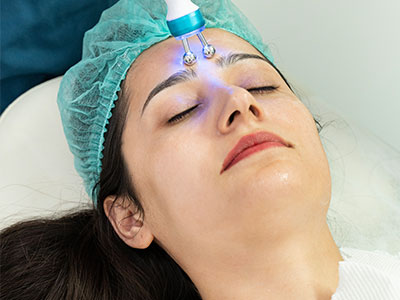 Electrocautery Treatment